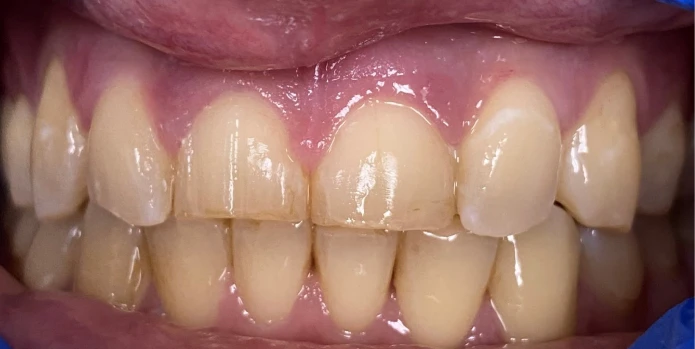 Before - Dental transformation